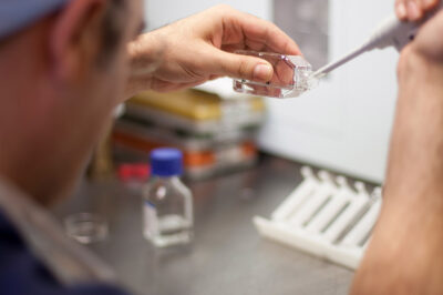 Sperm and Eggs Samples - ivf - in vitro fertilization, egg freezing or working with Micro Pipette vaccine, treatment or medicine research. IVF laboratory embryo biotechnology fertility treatment